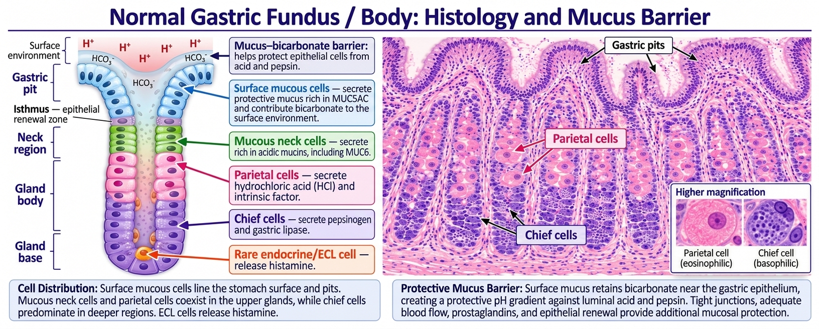 Educational diagram of normal stomach fundus and body showing gastric pits, surface mucous cells, mucous neck cells, parietal cells, chief cells, and an ECL cell